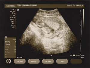 ultrasound 2014-10-23 3.jpg